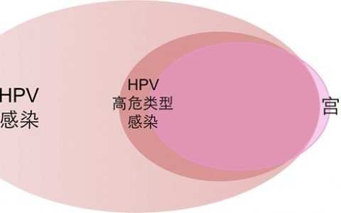 HPV和宫颈癌有何关系 HPV疫苗咋打 干货在这