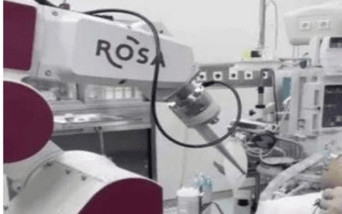 天津第一中心医院ROSA机器人辅助植入脑起搏器