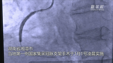 冠脉支架降到700余元，百姓关注质量有保证吗？