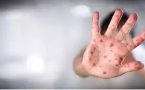 家有儿童的注意了：手足口病高发季需做好防护